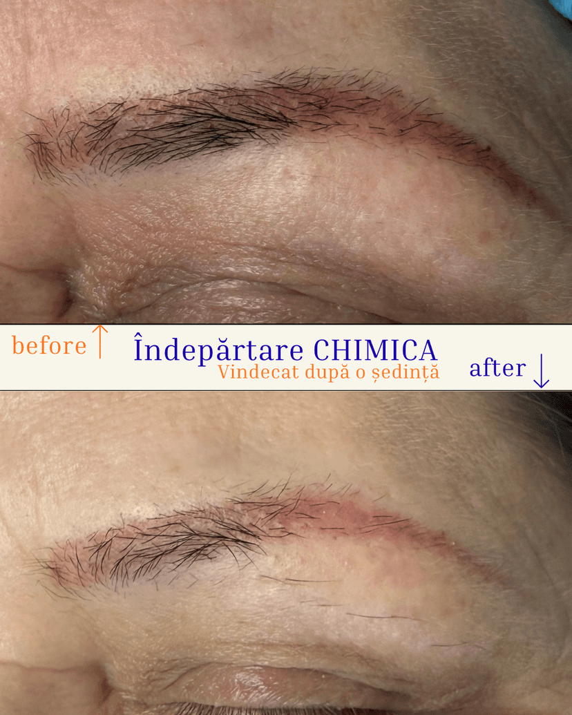 indepartare_chimica.png